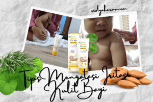 krim untuk iritasi kulit bayi karena pampers