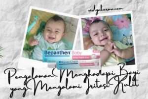 mengatasi bayi iritasi kulit