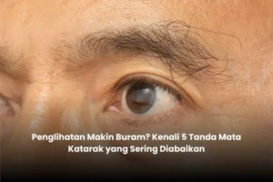 Penglihatan Makin Buram? Kenali 5 Tanda Mata Katarak yang Sering Diabaikan