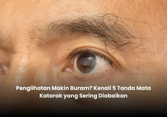 Penglihatan Makin Buram? Kenali 5 Tanda Mata Katarak yang Sering Diabaikan